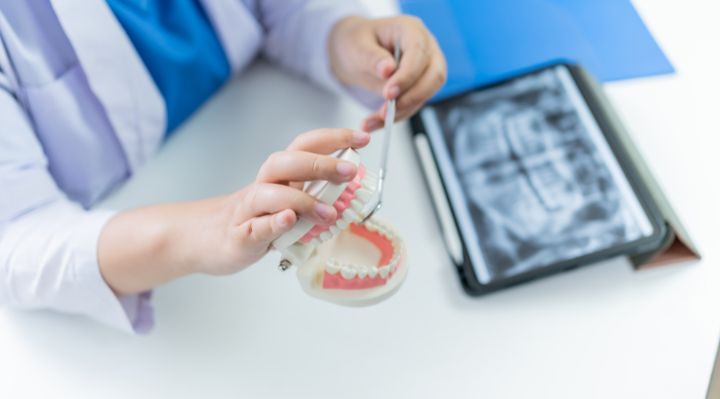 前歯のみのマウスピース矯正の診断を行う画像