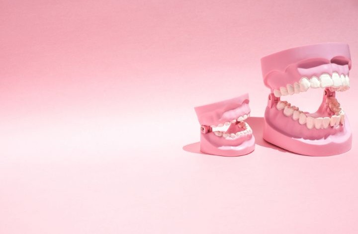 まとめ（マウスピース矯正による開咬治療の可能性に関する結論）